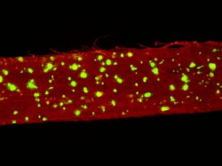 Skin cells grown into nanofiber scaffold 887x665